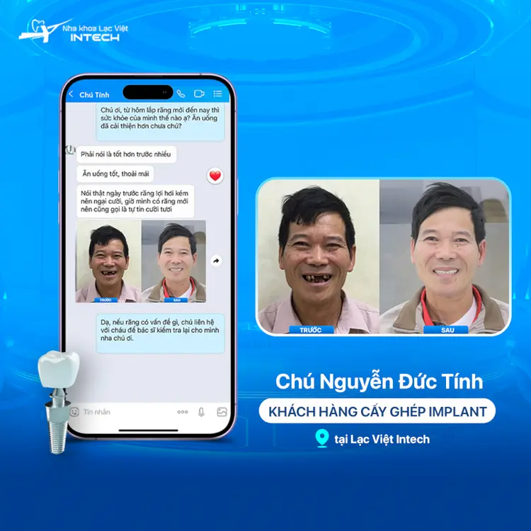 Chính sách bảo hành và hậu mãi là yếu tố quan trọng khi lựa chọn địa điểm phục hình răng Implant và bọc mão sứ