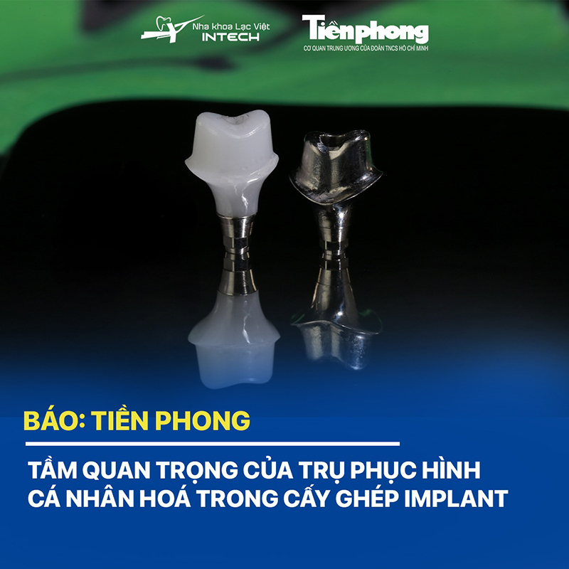 Trụ phục hình cá nhân hóa được thiết kế theo cấu trúc giải phẫu của từng người, có thể làm từ vật liệu Titanium (màu xám kim loại) hoặc Zirconia (màu trắng trong)