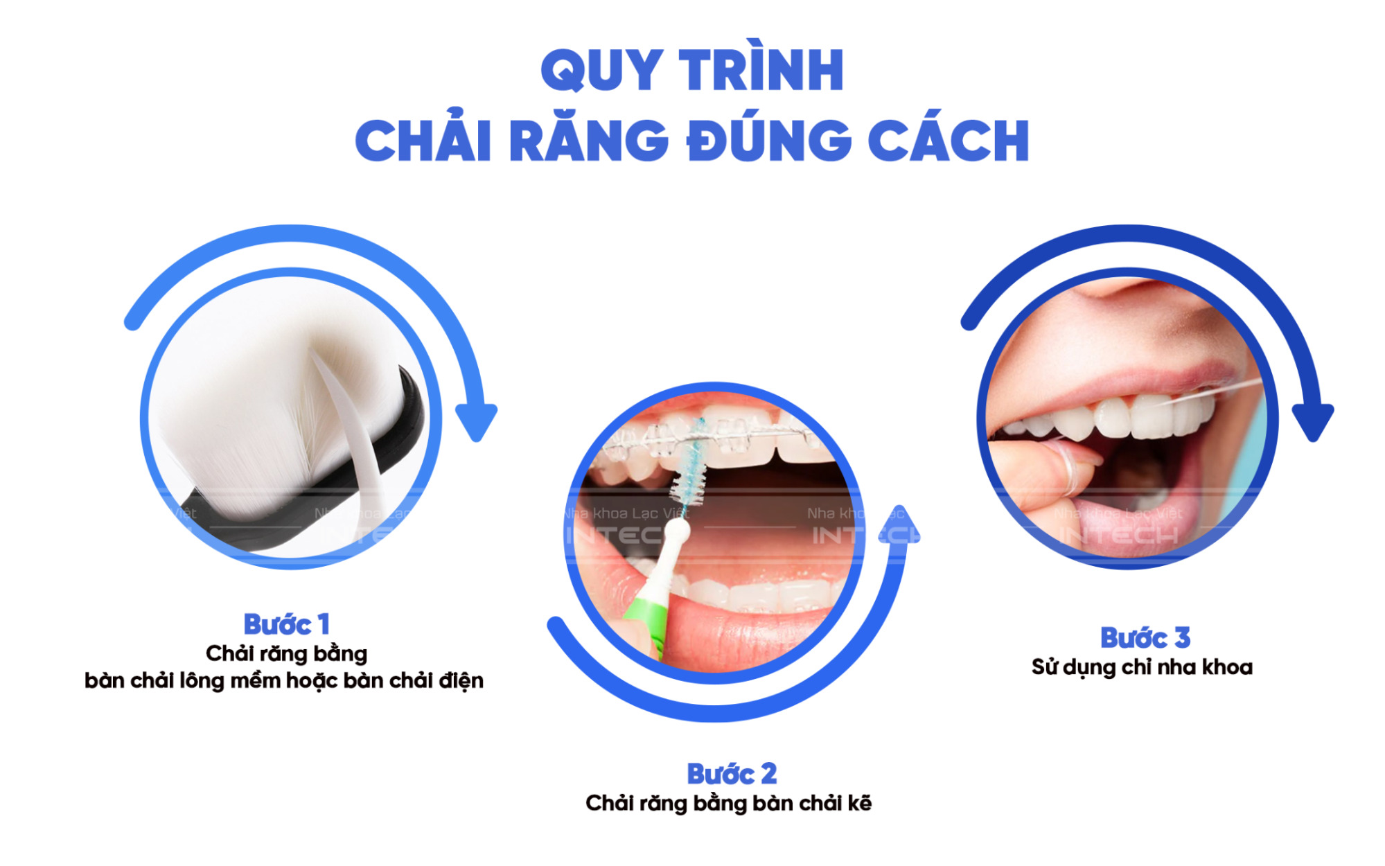 Bạn nên vệ sinh răng miệng sau khi niềng đúng cách để có một nụ cười tự tin