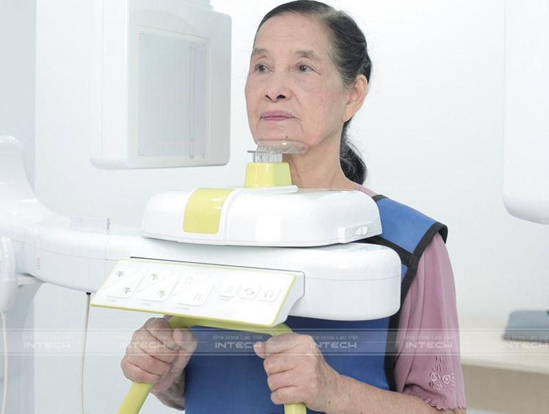 Bệnh nhân được chụp phim CT Cone beam khảo sát xương hàm
