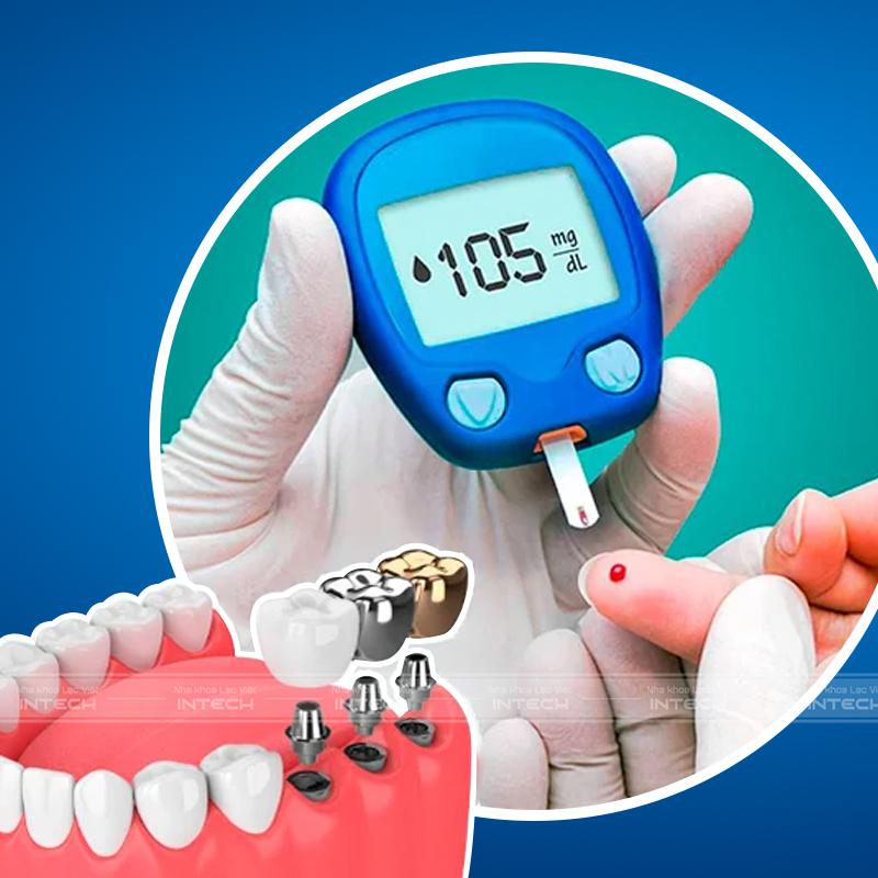 Bệnh tiểu đường ảnh hưởng đến quá trình cấy ghép implant