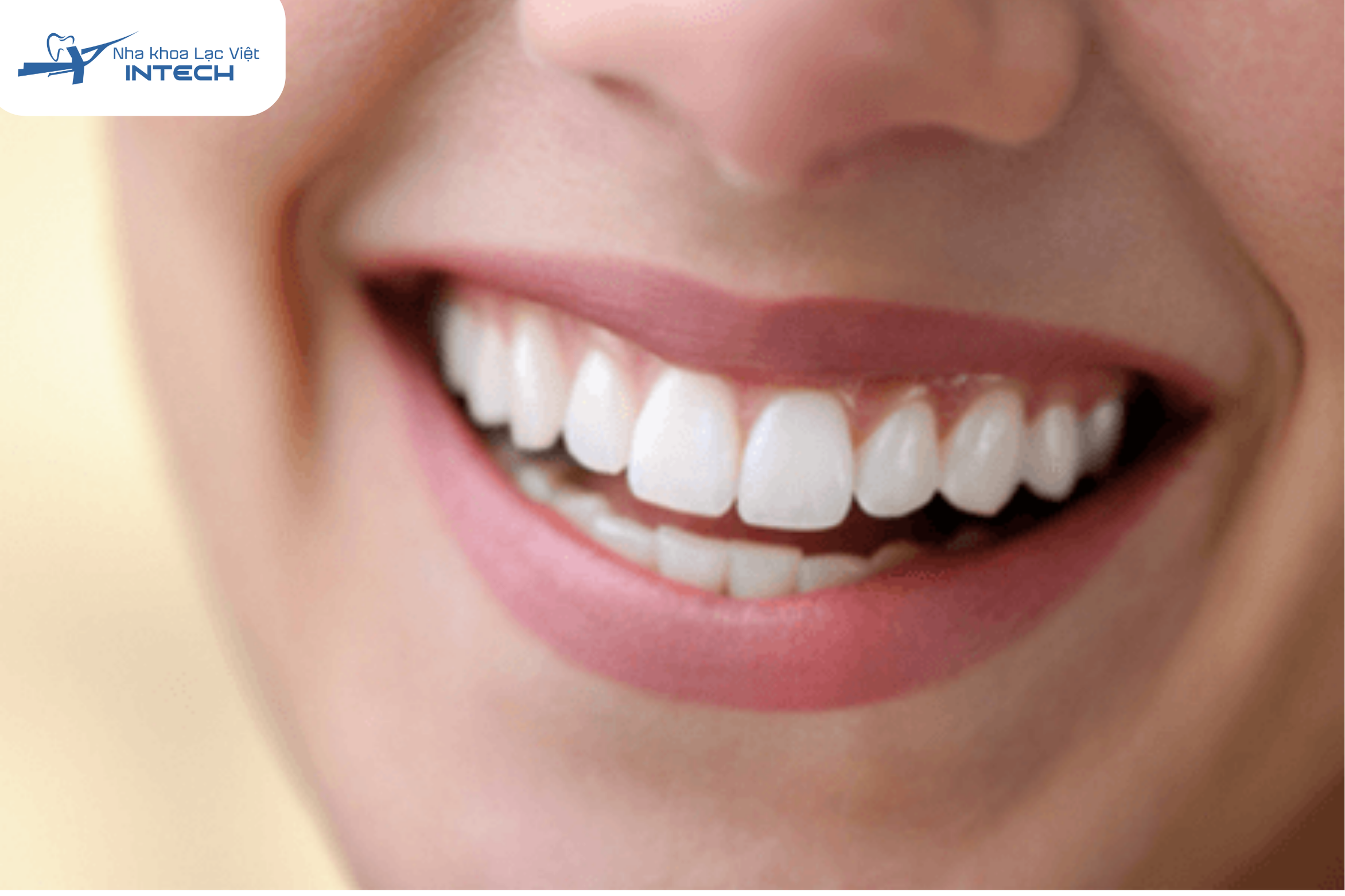 Bọc răng sứ giúp che những khuyết điểm về răng, giúp cô chú anh chị tự tin hơn trong việc giao tiếp