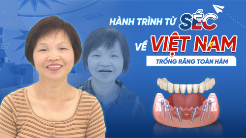 HÀNH TRÌNH TỪ SÉC TRỞ VỀ VIỆT NAM TRỒNG RĂNG VÀ CÁI KẾT VIÊN MÃN