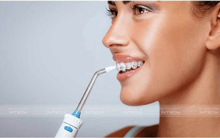 các giai đoạn của niềng răng