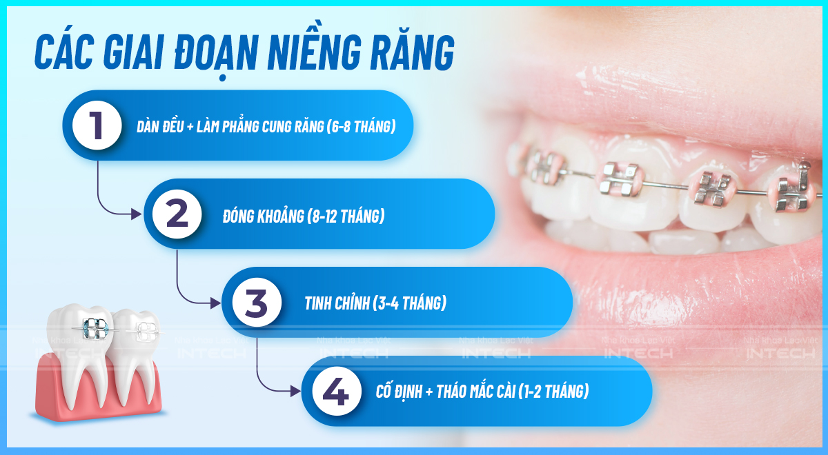 các giai đoạn niềng răng