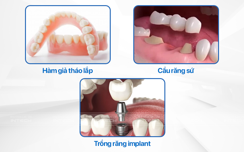 Các phương pháp trồng răng giả hiện nay