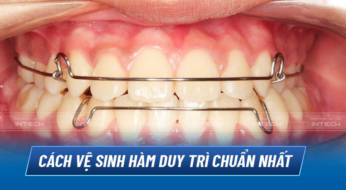 Hàm duy trì tháo lắp kim loại có lực ổn định và độ bền cao