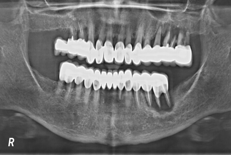 Công nghệ chụp ảnh X-quang giúp xác định rõ tình trạng xương hàm  
