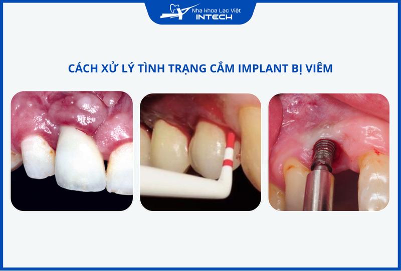 Khi xuất hiện các dấu hiệu bất thường cần thăm khám bác sĩ ngay để được xử lý kịp thời.