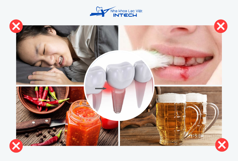 Quá trình chăm sóc không đúng cách tác động lực mạnh vào vùng mới cấy ghép hoặc kiêng khem không đúng cách cũng dẫn tới nguy cơ đào thải trụ Implant