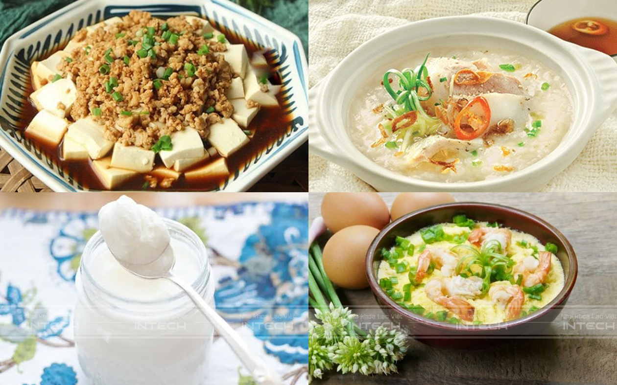 cắm vis niềng răng