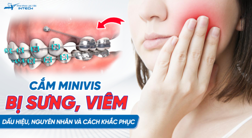 Cắm minivis bị viêm sưng: Dấu hiệu, nguyên nhân và biện pháp khắc phục