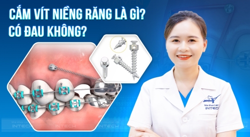 CẮM VIS NIỀNG RĂNG CÓ ĐAU KHÔNG? RỦI RO KHI CẮM VIS 