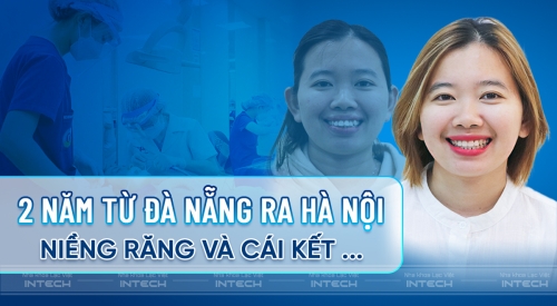 Hành trình 2 năm từ Đà Nẵng ra Hà Nội niềng răng của cô gái 28 tuổi Nguyễn Thị Như Anh