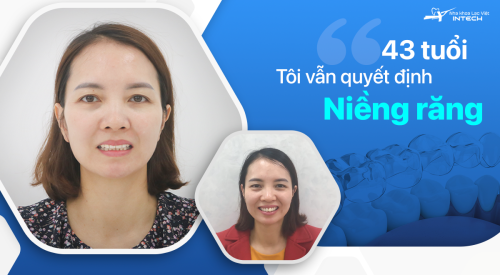 43 tuổi, tôi vẫn quyết định niềng răng…
