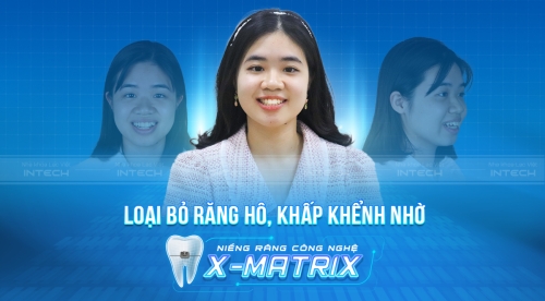 HỐI HẬN VÌ NIỀNG RĂNG… QUÁ MUỘN!