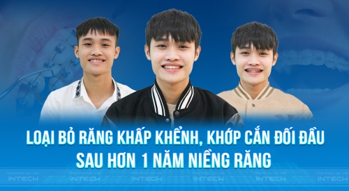 Niềng răng để tự tin hơn - Tại sao không?