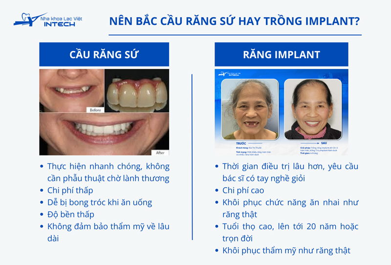 Cầu răng sứ và Implant đều có ưu nhược điểm riêng, cô chú/anh chị nên cân nhắc dựa trên nhu cầu và điều kiện tài chính