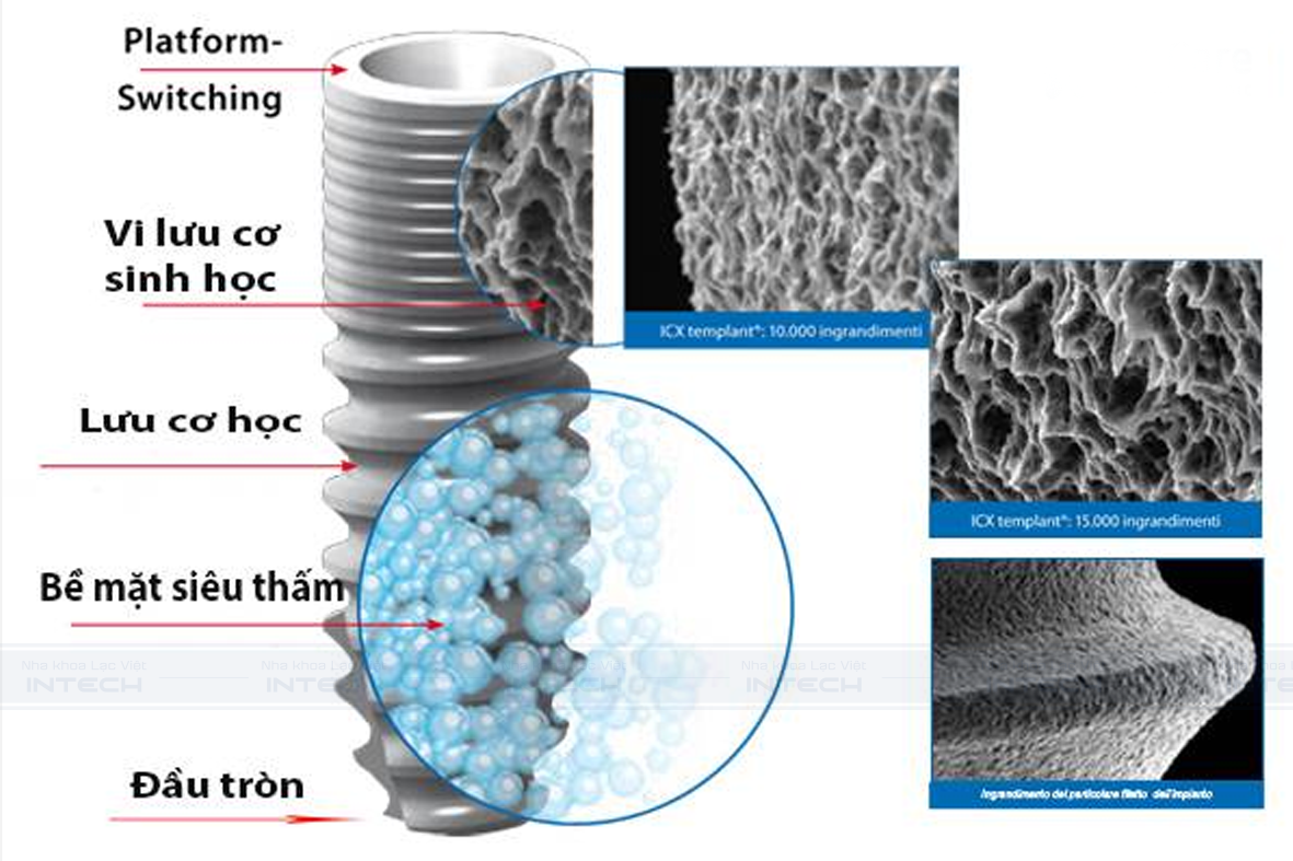 Cấu tạo trụ Implant ICX Đức