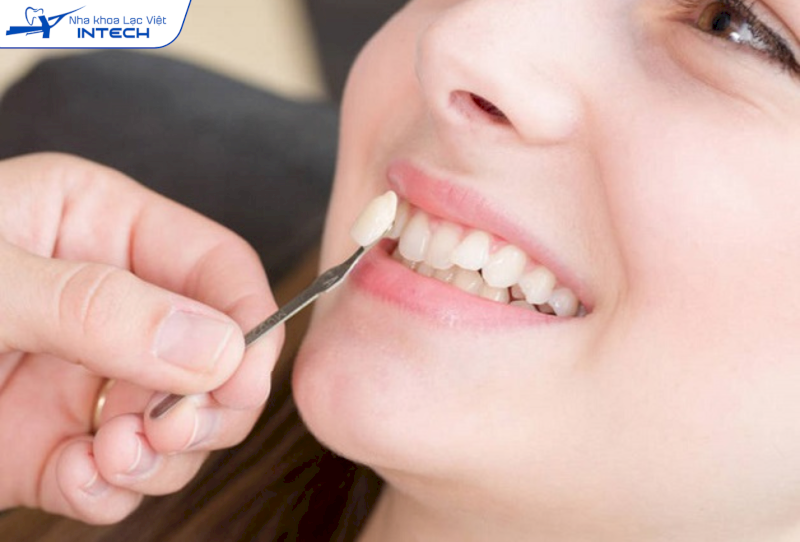 Với các trường hợp đắp hoặc dán răng khểnh, cô chú/anh chị có thể đến nha khoa để bác sĩ hỗ trợ tháo nếu có nhu cầu