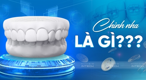 Chỉnh nha là gì? Giải đáp tất cả thắc mắc về chỉnh nha