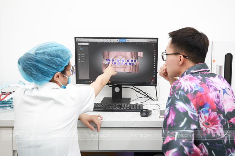 Giải pháp X-Matrix xem trước kết quả niềng răng, niềng răng không đau 