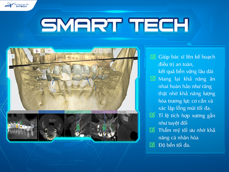 Công nghệ Smart tech