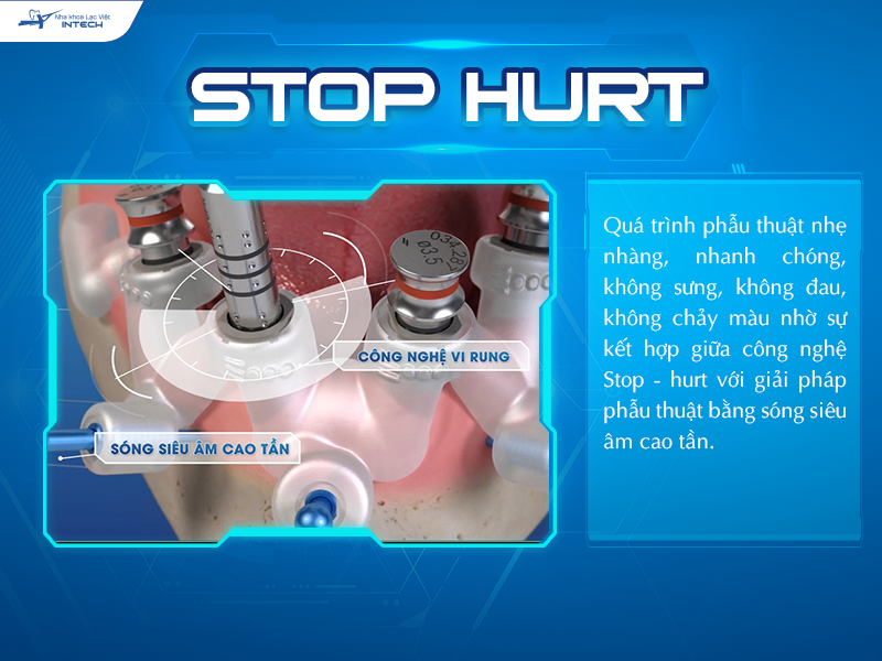 Công nghệ Stop hurt