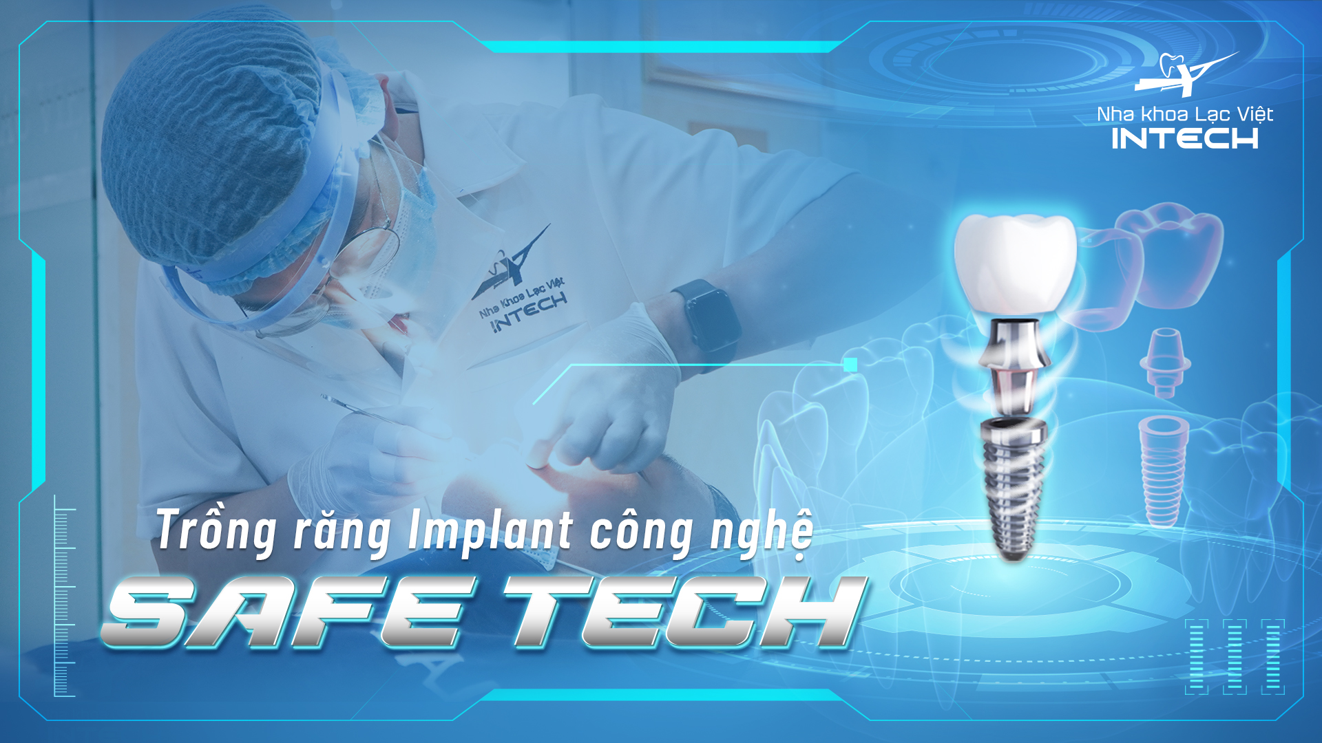 Công nghệ Safe Tech giúp quá trình trồng răng diễn ra nhanh chóng, không đau