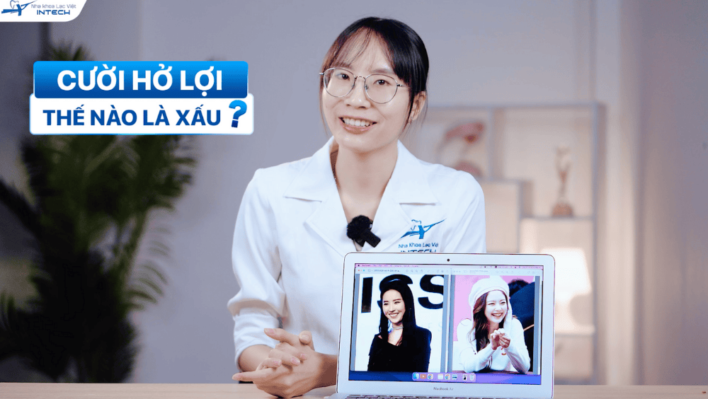 Thế nào là nụ cười hở lợi đẹp?