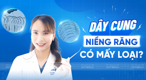 Dây cung niềng răng là gì? Vai trò và 6 loại dây cung phổ biến
