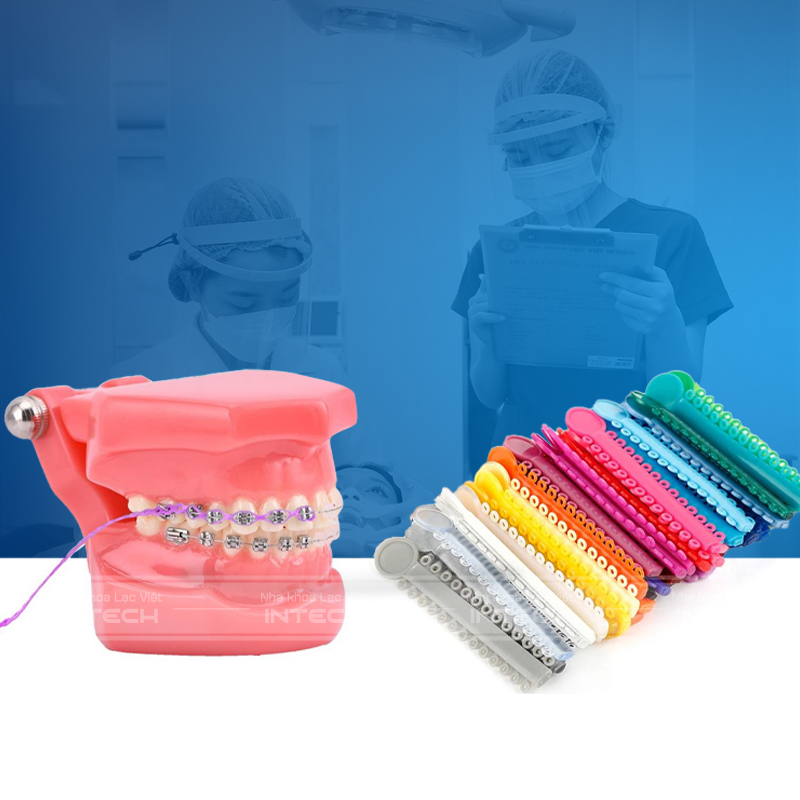Nên thay dây chun thường xuyên để vừa đảm bảo lực kéo răng vừa tránh tình trạng dây chun bị vàng