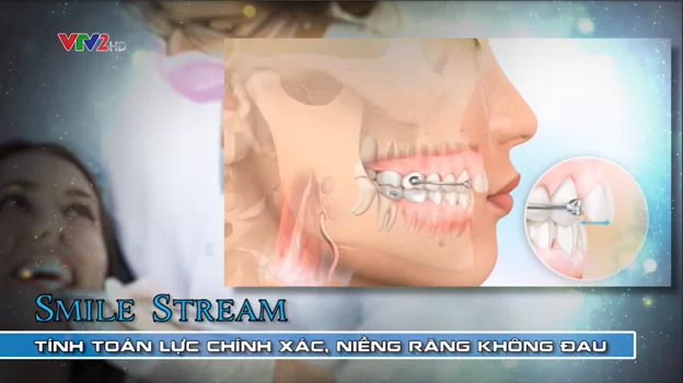Công nghệ Webceph