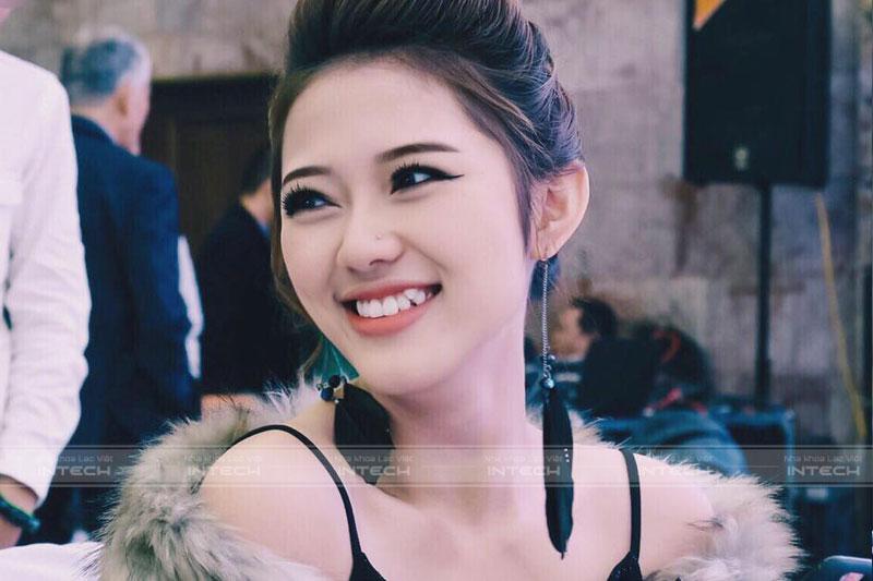 Diễn viên Trang Cherry với chiếc răng khểnh duyên dáng