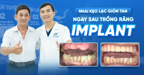 "NHỜ TRỒNG RĂNG IMPLANT MÀ ĂN ĐƯỢC KẸO LẠC, QUÁ TUYỆT VỜI"!