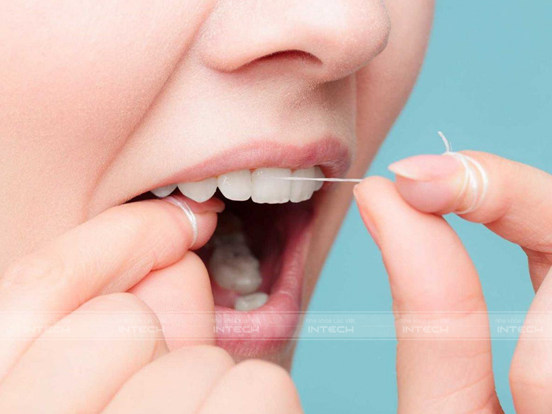 Chỉ nha khoa có dạng sợi mảnh, dẻo dai và rất dễ sử dụng