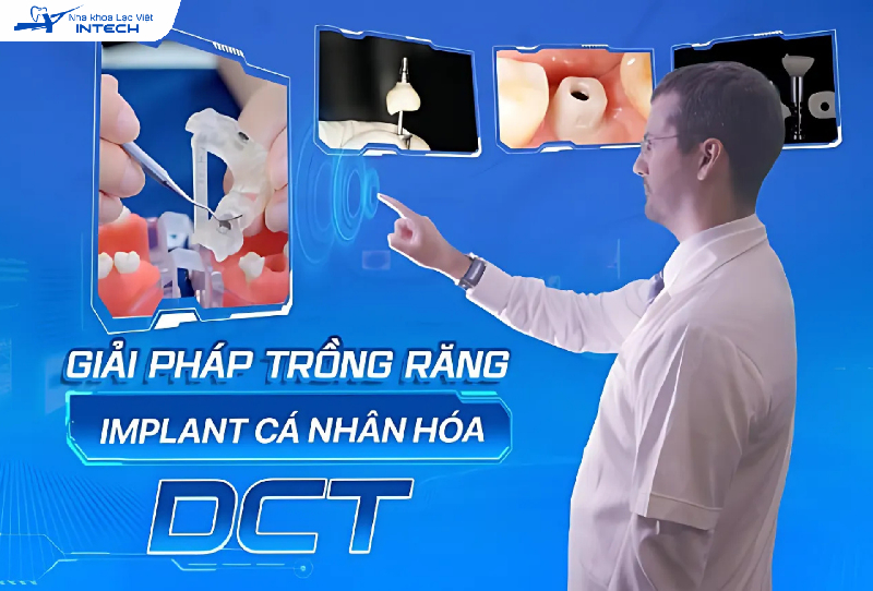 trồng răng cá nhân hoá DCT