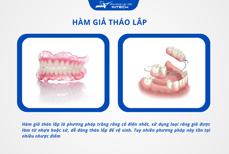 Hàm giả tháo lắp (răng giả tháo lắp) là phương pháp phục hình răng cổ điển nhất, cho khả năng ăn nhai kém và không đảm bảo thẩm mỹ