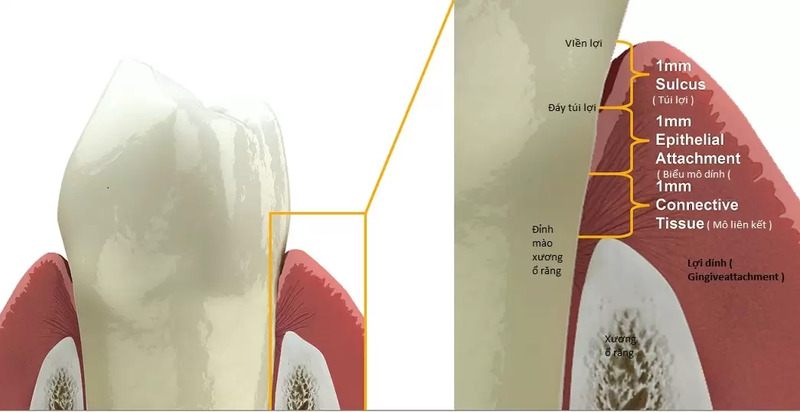 Việc tái lập lại khoảng sinh học sẽ quyết định thành công lâu dài của răng Implant