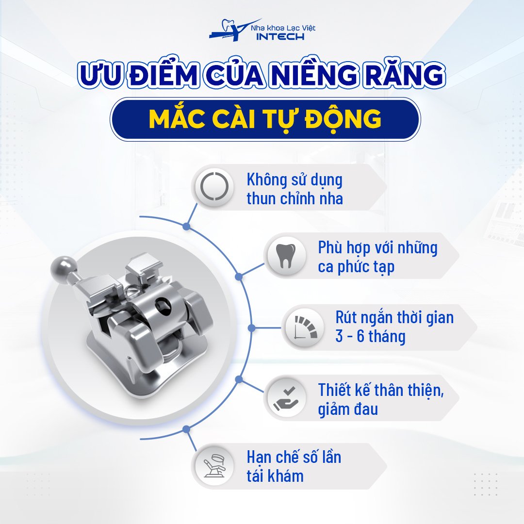hô hàm trên có niềng răng được không