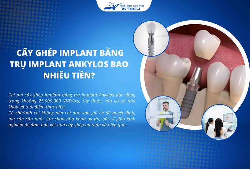 Chi phí cấy ghép Implant bằng trụ Implant Ankylos tùy thuộc vào cơ sở nha khoa và thời điểm thực hiện