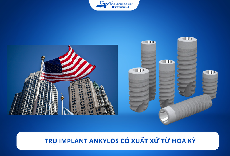 Trụ Implant Ankylos: Xuất xứ, đặc điểm, ưu và nhược điểm