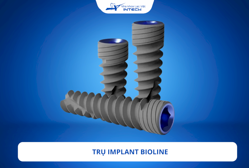 Trụ Implant BioLine được đánh giá cao nhờ thiết kế tối ưu giúp trụ tồn tại ổn định trong xương hàm