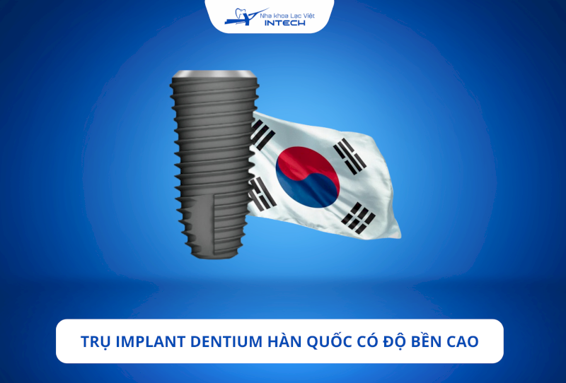 Một trong những ưu điểm lớn nhất của Implant Dentium Hàn Quốc là độ bền cao, thậm chí có thể tồn tại cả đời nếu được chăm sóc tốt