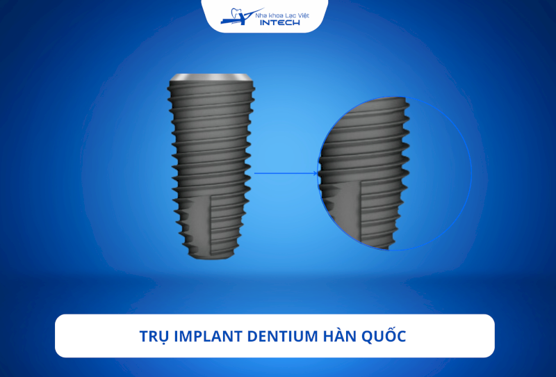 Thiết kế nhiều vòng ren giúp Implant Dentium chống xoay, cố định tốt vào xương hàm