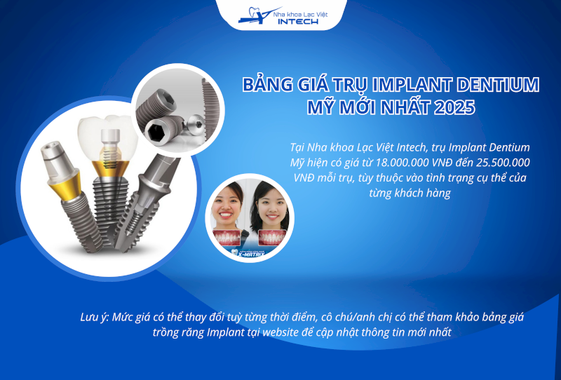Mức giá trồng răng với trụ Implant Dentium Mỹ tùy vào cơ sở nha khoa và thời điểm thực hiện