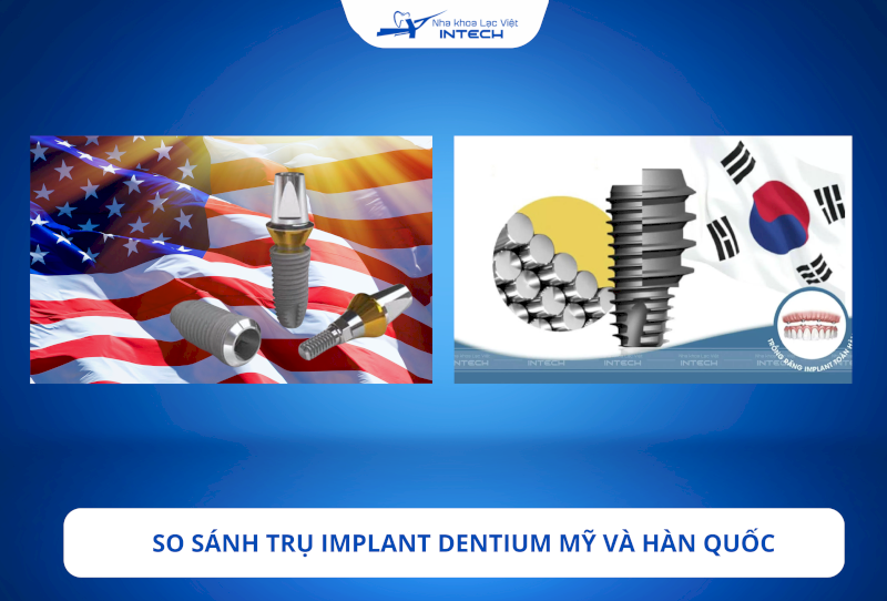 Trụ Implant Dentium Mỹ và Hàn Quốc có một số điểm khác biệt rõ rệt, thuộc hai phân khúc giá khác nhau, đáp ứng các nhu cầu phục hình răng khác nhau