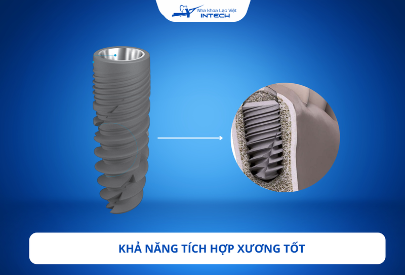 Nhờ vào vật liệu và áp dụng các công nghệ tiên tiến vào cấy ghép, trụ Implant ETK Active có khả năng tích hợp tốt với xương hàm  