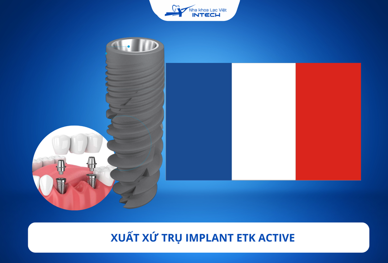 Trụ Implant ETK Active: Xuất xứ, cấu tạo và chi phí