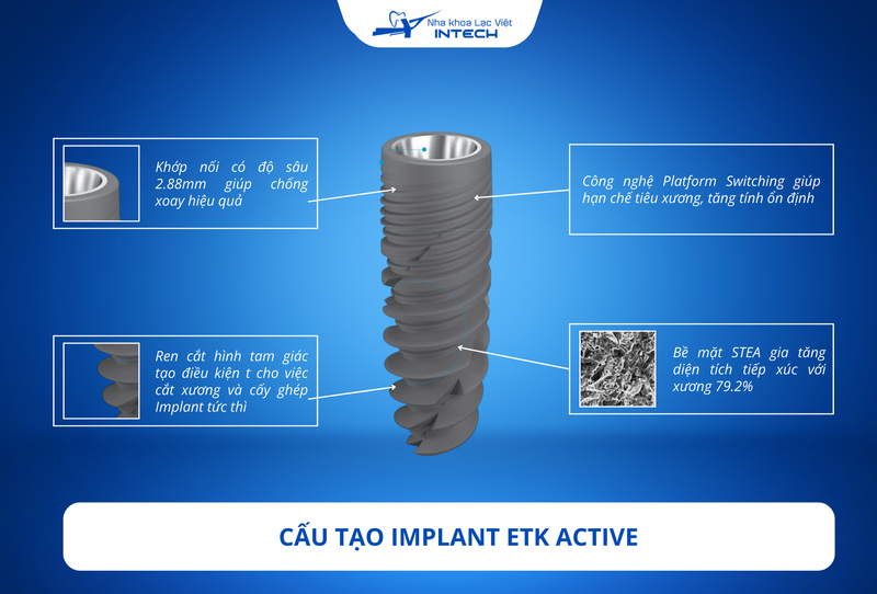 Trụ Implant ETK Active được ứng dụng công nghệ hiện đại nhằm tối ưu tốt kết quả phục hình  